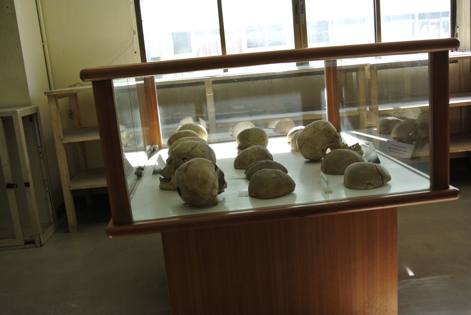  Siriraj Museum ou le Musée des curiosités médicales